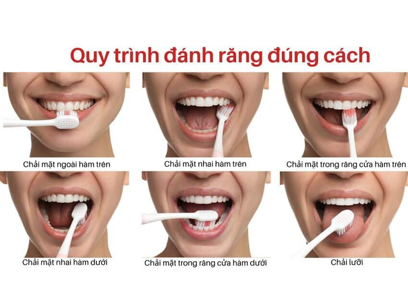 chai-rang-dung-cach-de-so-huu-ham-rang-trang-khoe-tuyet-voi