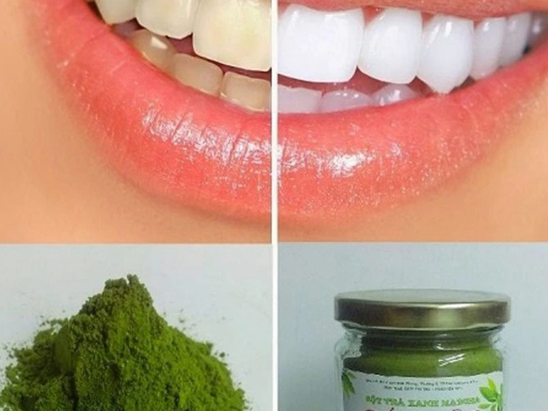 diem-mat-nhung-thuc-pham-tot-giup-rang-trang-sang-ma-ban-nen-an