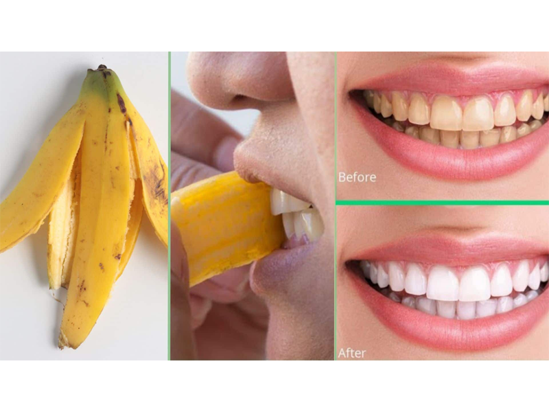 meo-lam-trang-rang-tu-vo-chuoi-chin