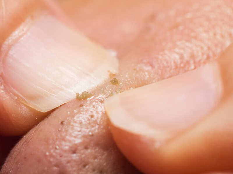 nan-mun-dau-den-the-nao-cho-dung