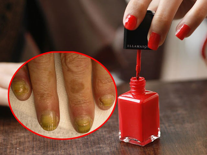 nhung-nguy-co-tiem-an-tu-viec-son-mong-tay-dang-gel