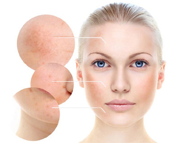 phong-tranh-nam-da-nhu-the-nao